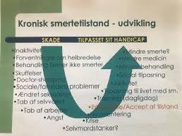 kjøp medisiner mot kroniske smerter